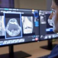 AI-tool toont automatisch levertumoren op CT-scan