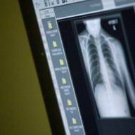 Medische beeldvorming en pathologie: een digitale vergelijking